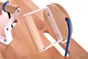 Handtherapie-Tisch Set 1