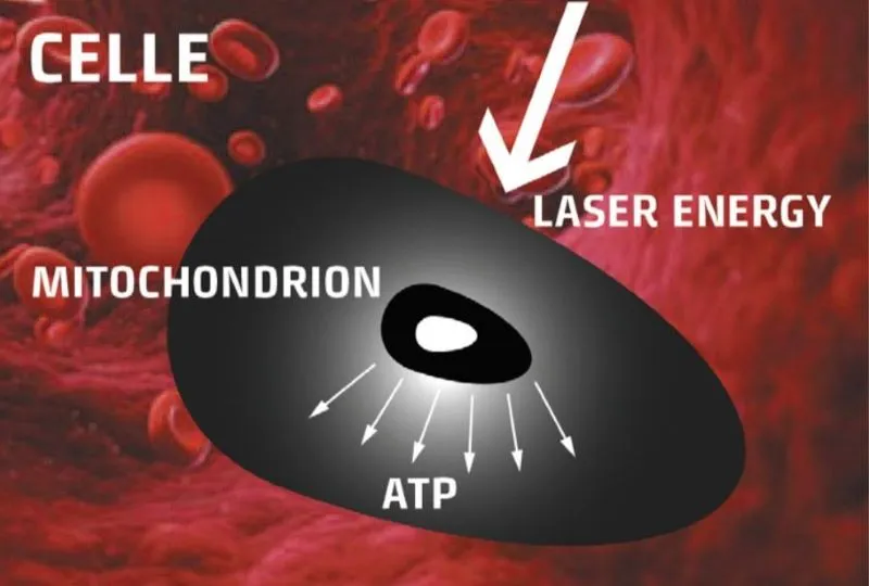 Lasertherapie